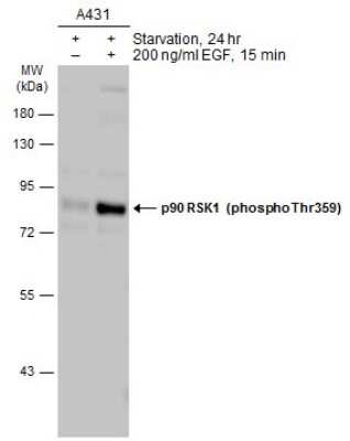 Western Blot: RSK1 [p Thr359] Antibody [NBP3-13253]